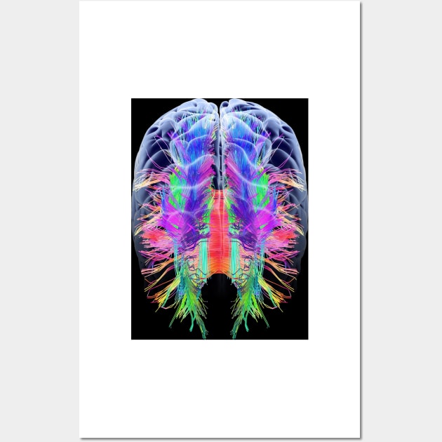 White matter fibres and brain, artwork (C015/1936) Wall Art by SciencePhoto